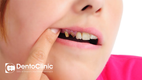 Fístula dental: Me ha salido un bulto ¿Qué hago?